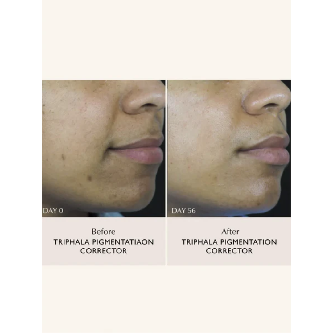 Sachi - Triphala Pigmentation Corrector
