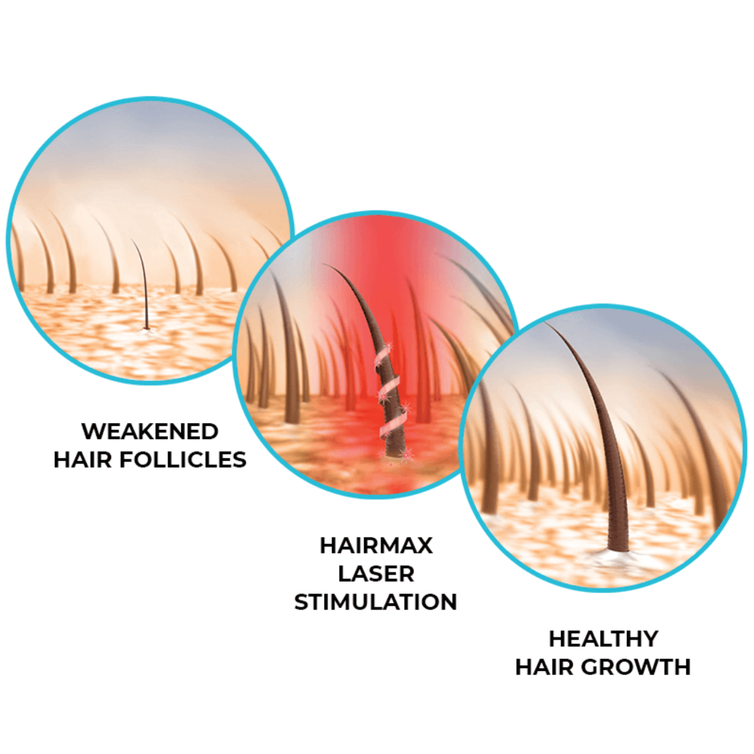 HairMax Laser Band 82