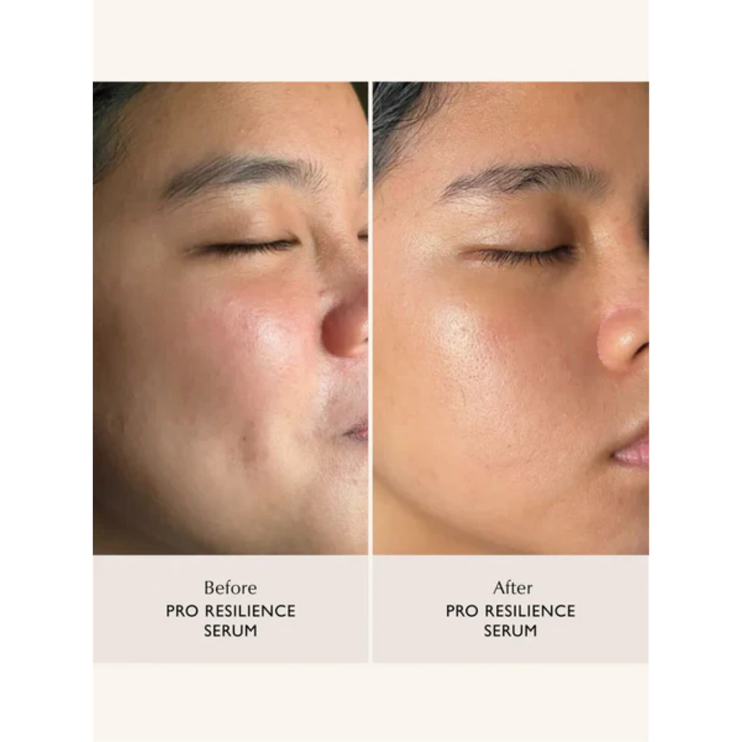 Sachi - Pro Resilience Serum