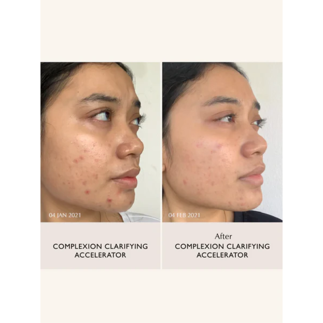 Sachi - Complexion Clarifying Accelerator