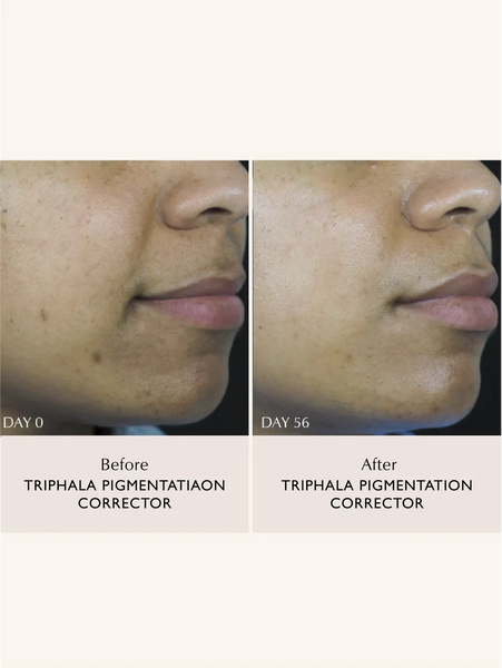 Sachi Skin - Triphala Pigmentation Corrector (30ML)